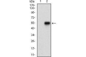Western blot analysis using ZEB1 mAb against HEK293 (1) and ZEB1 (AA: 967-1108)-hIgGFc transfected HEK293 (2) cell lysate. (ZEB1 anticorps  (AA 967-1108))