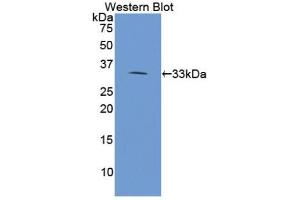 Detection of Recombinant PLA2R1, Human using Polyclonal Antibody to Phospholipase A2 Receptor 1 (PLA2R1) (PLA2R1 anticorps  (AA 385-643))