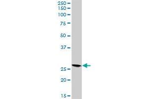 VAPB MaxPab rabbit polyclonal antibody. (VAPB anticorps  (AA 1-243))
