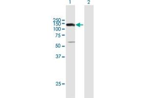 Western Blot analysis of UTP14A expression in transfected 293T cell line by UTP14A MaxPab polyclonal antibody. (UTP14A anticorps  (AA 1-771))