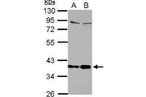 WB Image Sample (30 ug of whole cell lysate) A: Jurkat B: Raji 10% SDS PAGE antibody diluted at 1:1000 (Selenoprotein P anticorps)