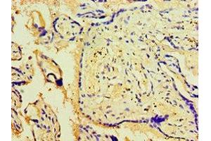 Immunohistochemistry of paraffin-embedded human placenta tissue using ABIN7175707 at dilution of 1:100 (WIPI1 anticorps  (AA 187-446))
