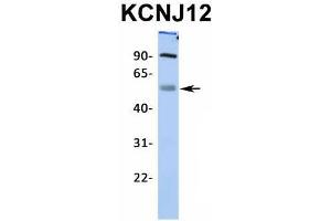 Host:  Rabbit  Target Name:  KCNJ12  Sample Type:  Human Fetal Muscle  Antibody Dilution:  1.