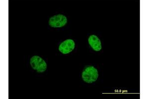 Immunofluorescence of purified MaxPab antibody to KBTBD9 on HeLa cell. (KLHL29 anticorps  (AA 1-503))