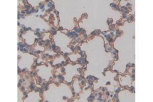 Used in DAB staining on fromalin fixed paraffin- embedded lung tissue