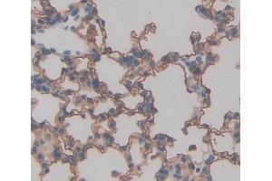 Used in DAB staining on fromalin fixed paraffin- embedded lung tissue (TAP2 anticorps  (AA 467-703))