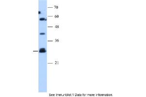 WB Suggested Anti-SOCS1 Antibody Titration: 1.