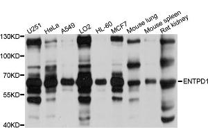 Western blot analysis of extracts of various cell lines, using ENTPD1 antibody (ABIN5971962) at 1/1000 dilution. (CD39 anticorps)