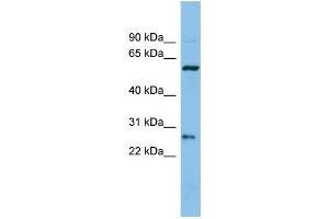 WB Suggested Anti-CTRB1 Antibody Titration: 0. (CTRB1 anticorps  (Middle Region))