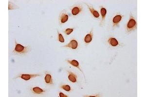 Immunocytochemistry analysis of ABIN7139152 diluted at 1:10 and staining in Hela cells (treated with 30mM sodium butyrate for 4h) performed on a Leica BondTM system.