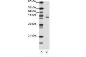 Image no. 1 for anti-Jumonji Domain Containing 4 (JMJD4) (C-Term) antibody (ABIN6736176) (JMJD4 anticorps  (C-Term))