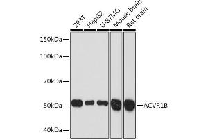 Western blot analysis of extracts of various cell lines, using B Rabbit mAb (ABIN1678826, ABIN3015929, ABIN3015930 and ABIN7101463) at 1:1000 dilution.