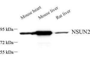 Western blot analysis of NSUN2 (ABIN7074858) at dilution of 1: 500 (NSUN2 anticorps)