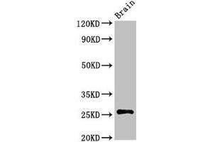 Western Blot Positive WB detected in: Rat brain tissue All lanes: ASCL1 antibody at 3 μg/mL Secondary Goat polyclonal to rabbit IgG at 1/50000 dilution Predicted band size: 26 kDa Observed band size: 26 kDa (ASCL1 anticorps  (AA 1-236))