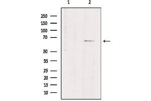 Western blot analysis of extracts from rat brain, using SLC7A4 Antibody. (SLC7A4 anticorps  (C-Term))