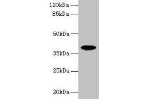 Western blot All lanes: FPR2 antibody at 8 μg/mL + HL60 whole cell lysate Secondary Goat polyclonal to rabbit IgG at 1/10000 dilution Predicted band size: 39 kDa Observed band size: 39 kDa