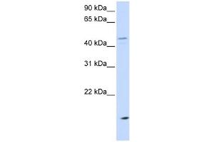 CETP antibody used at 1 ug/ml to detect target protein. (CETP anticorps  (N-Term))