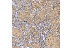 IHC analysis of Cytokeratin 2e/KRT2 using anti-Cytokeratin 2e/KRT2 antibody (ABIN7600644).