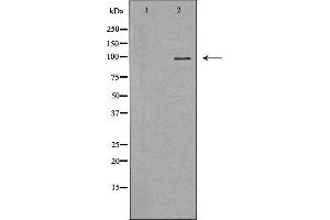 Western blot analysis of Hela whole cell lysates, using MVP Antibody. (MVP anticorps  (N-Term))