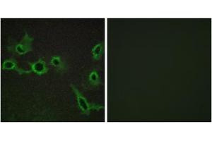 Immunofluorescence analysis of COS-7 cells, using HTR7 antibody. (HTR7 anticorps  (C-Term))