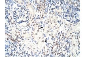 HKR1 antibody was used for immunohistochemistry at a concentration of 4-8 ug/ml to stain Epithelial cells of renal tubule (arrows) in Human Kidney. (HKR1 anticorps  (C-Term))