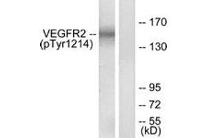 Western blot analysis of extracts from HepG2 cells treated with Na3VO4 0. (VEGFR2/CD309 anticorps  (pTyr1214))