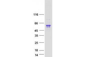 Validation with Western Blot
