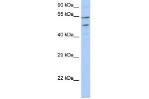 WB Suggested Anti-TMCC3 Antibody Titration:  0. (TMCC3 anticorps  (N-Term))