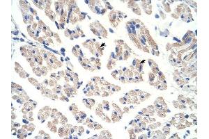 ACO1 antibody was used for immunohistochemistry at a concentration of 12.