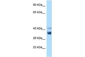 WB Suggested Anti-Nek7 Antibody Titration: 1. (NEK7 anticorps  (C-Term))