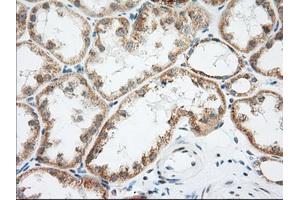 Immunohistochemical staining of paraffin-embedded Human Kidney tissue using anti-LOX mouse monoclonal antibody. (LOX anticorps  (AA 22-168))