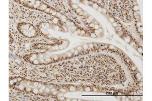 Immunoperoxidase of monoclonal antibody to OXSR1 on formalin-fixed paraffin-embedded human small Intestine. (OXSR1 anticorps  (AA 351-450))