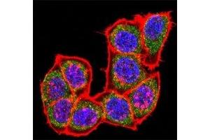 Confocal immunofluorescent analysis of p38 antibody with HeLa cells followed by Alexa Fluor 488-conjugated goat rabbit lgG (green).