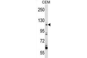 Western Blotting (WB) image for anti-rho Guanine Nucleotide Exchange Factor (GEF) 1 (ARHGEF1) antibody (ABIN2998307) (ARHGEF1 anticorps)