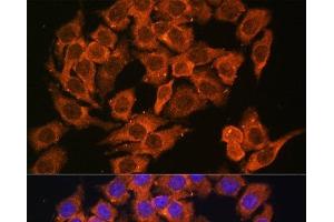 Immunofluorescence analysis of HeLa cells using MYO6 Polyclonal Antibody at dilution of 1:100. (Myosin VI anticorps)