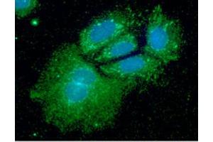 ICC/IF analysis of SHMT1 in Hep3B cells line, stained with DAPI (Blue) for nucleus staining and monoclonal anti-human SHMT1 antibody (1:100) with goat anti-mouse IgG-Alexa fluor 488 conjugate (Green).