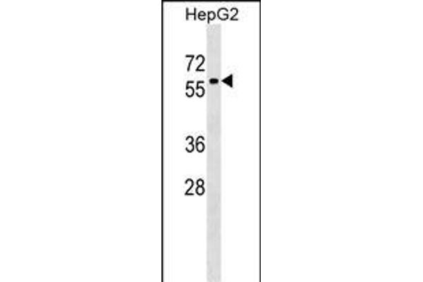 ZNF419 anticorps  (AA 176-202)