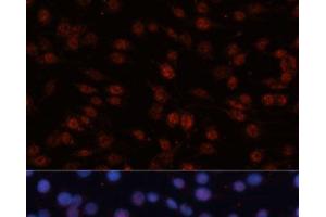 Immunofluorescence analysis of C6 cells using TCF4 Polyclonal Antibody at dilution of 1:100 (40x lens).