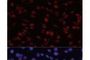 Immunofluorescence analysis of C6 cells using TCF4 Polyclonal Antibody at dilution of 1:100 (40x lens). (TCF4 anticorps)