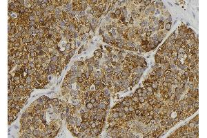ABIN6279111 at 1/100 staining Human pancreas tissue by IHC-P. (ALMS1 anticorps  (C-Term))