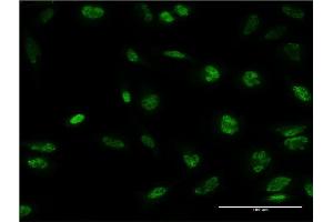 Immunofluorescence of monoclonal antibody to STK32B on HeLa cell.