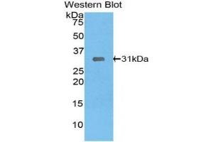 Western blot analysis of the recombinant protein. (LIMS1 anticorps  (AA 68-303))