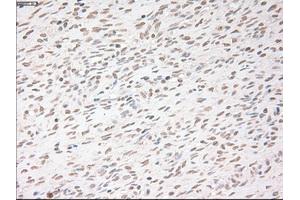 Immunohistochemical staining of paraffin-embedded colon tissue using anti-USP13mouse monoclonal antibody. (USP13 anticorps)