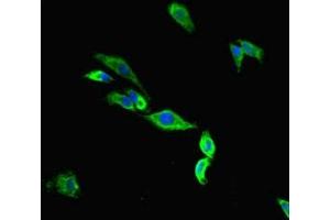 Immunofluorescent analysis of Hela cells using ABIN7172969 at dilution of 1:100 and Alexa Fluor 488-congugated AffiniPure Goat Anti-Rabbit IgG(H+L) (Tmc2 anticorps  (AA 6-206))