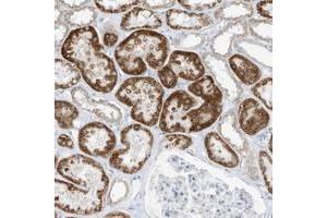 Immunohistochemical staining of human kidney with OGT polyclonal antibody  shows moderate cytoplasmic positivity in cells in tubules at 1:10-1:20 dilution. (OGT anticorps)