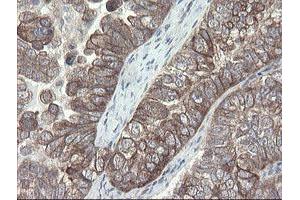 Image no. 13 for anti-Prefoldin Subunit 3 (PFDN3) antibody (ABIN1501702)