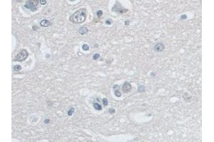 Detection of SNRPD1 in Human Cerebrum Tissue using Polyclonal Antibody to Small Nuclear Ribonucleoprotein Polypeptide D1 (SNRPD1) (SNRPD1 anticorps  (AA 1-119))