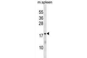 Western Blotting (WB) image for anti-5,10-Methenyltetrahydrofolate Synthetase (5-Formyltetrahydrofolate Cyclo-Ligase) (MTHFS) antibody (ABIN3000360) (MTHFS anticorps)