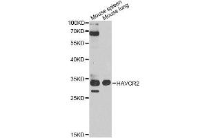 Western blot analysis of extracts of various cell lines, using HAVCR2 antibody. (TIM3 anticorps  (AA 1-100))