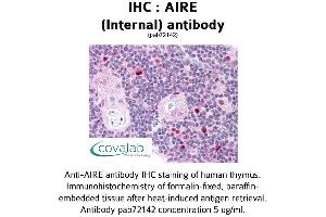 Image no. 1 for anti-Autoimmune Regulator (AIRE) (Internal Region) antibody (ABIN1731636)